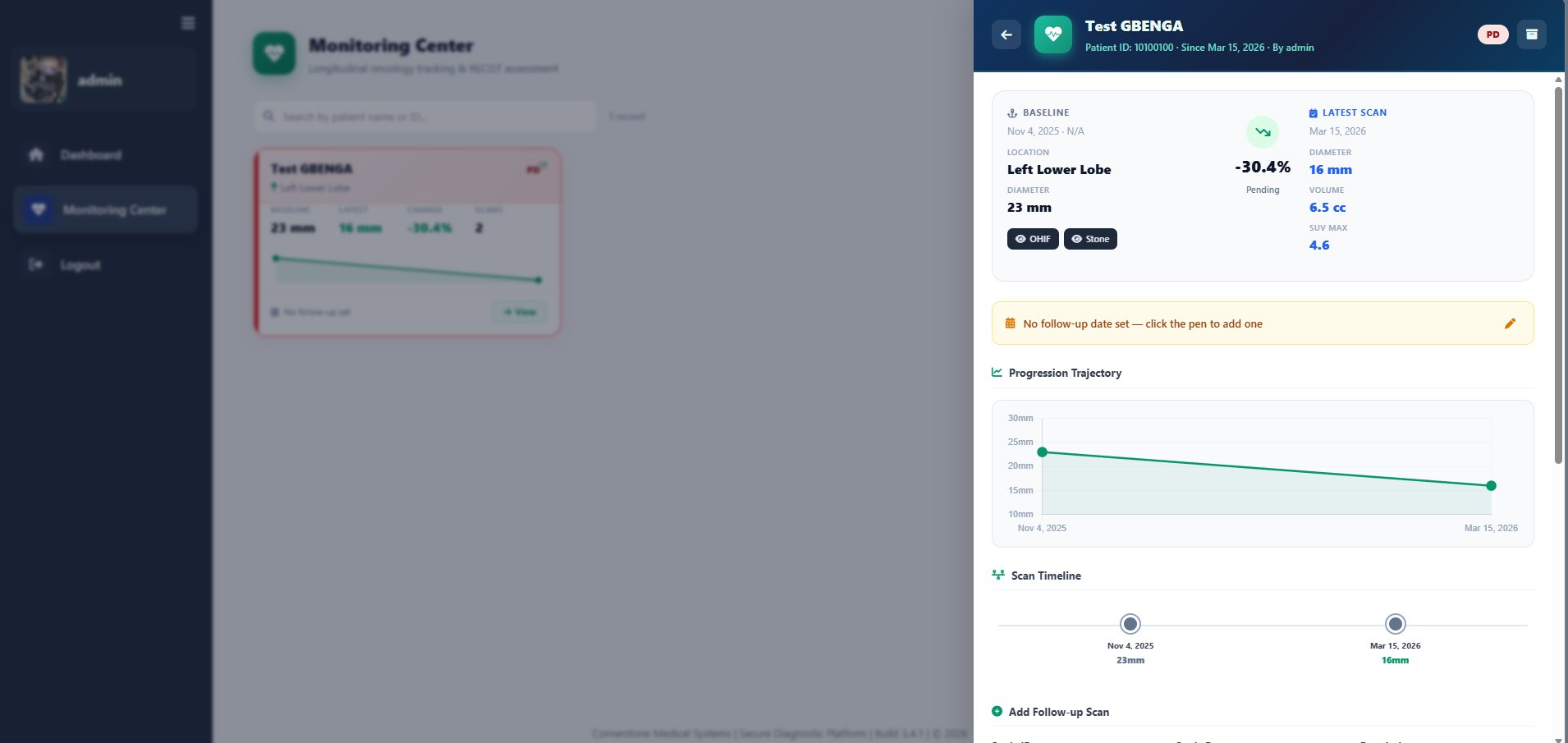 RECIST monitoring center showing lesion progression trajectory and scan timeline