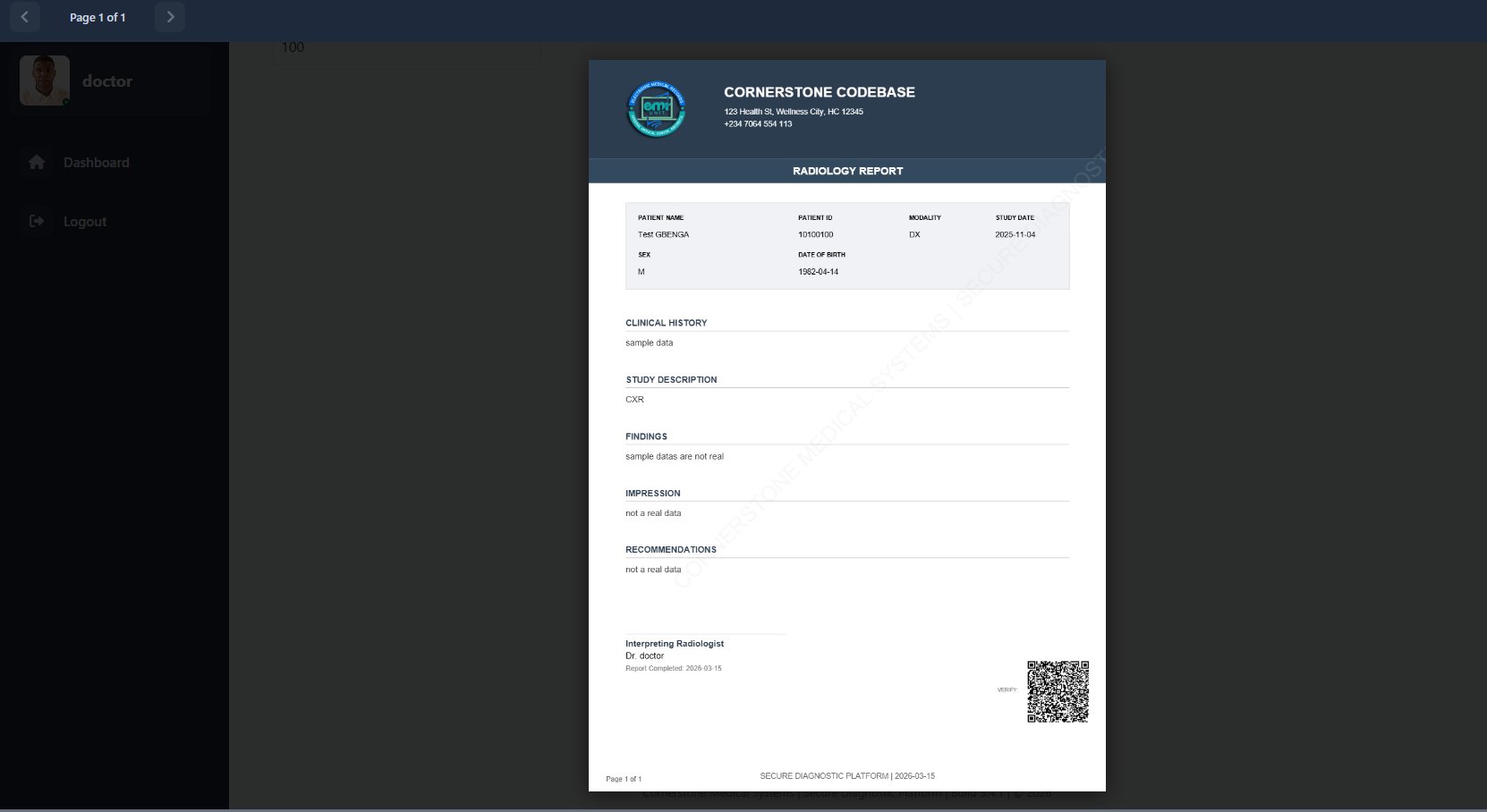 Cornerstone radiology report PDF showing clinical history, findings, impression, recommendations and QR verification
